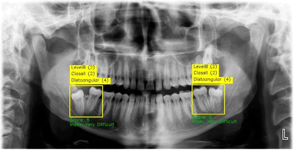 Diş Hekimliğinde Yapay Zekâ Dönemi: Teşhiste %99 Doğrulukla "Sıfır Hata" Hedefi
